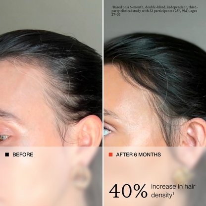 HAIR SCALP SERUM