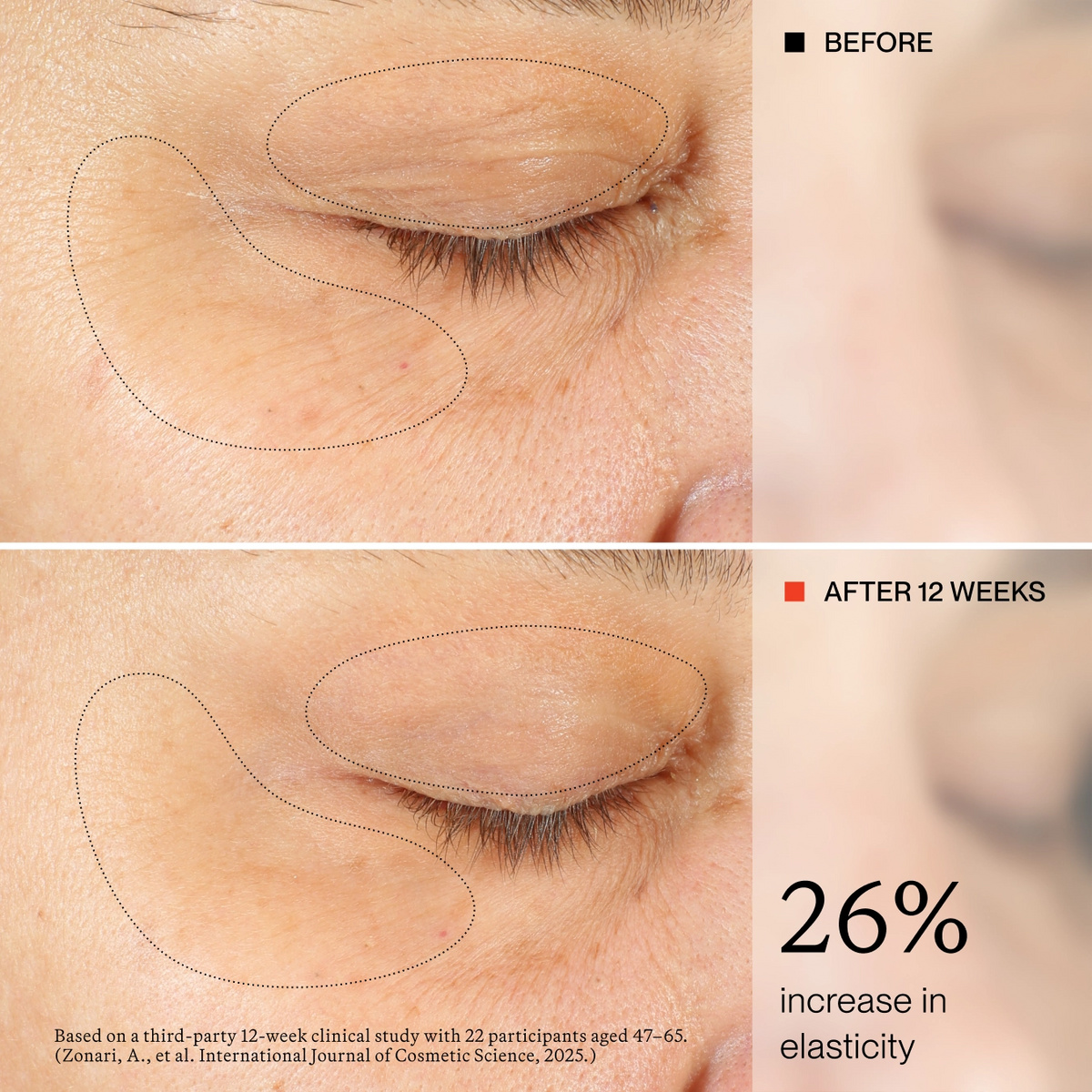 EYE CREAM