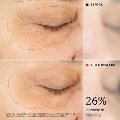 EYE CREAM