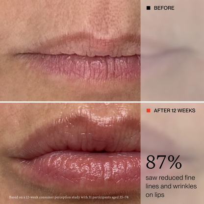 LIP MASK